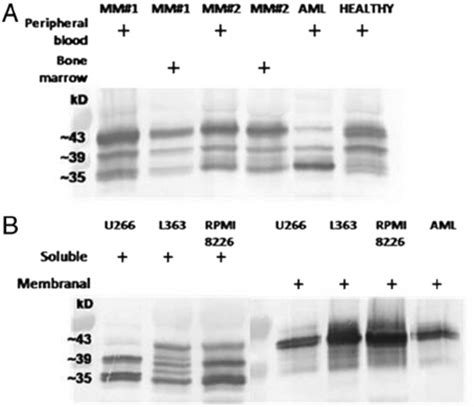 Western Blot Analysis Of Immunoaffinity Purified Hla I Molecules A