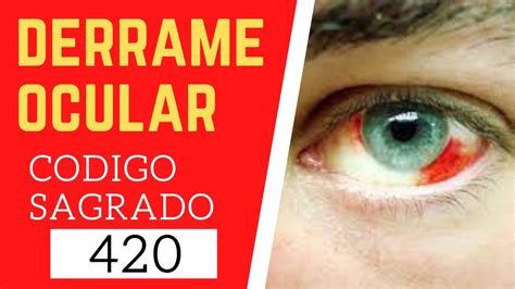 Código Sagrado 420 para el Derrame Ocular hemorragia subconjuntival