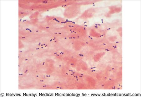 FS3 U7 Bacterial Infections CNS 1 2 Flashcards Quizlet