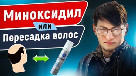 ПЕРЕСАДКА ВОЛОС или МИНОКСИДИЛ ? | Что лучше выбрать? - YouTube