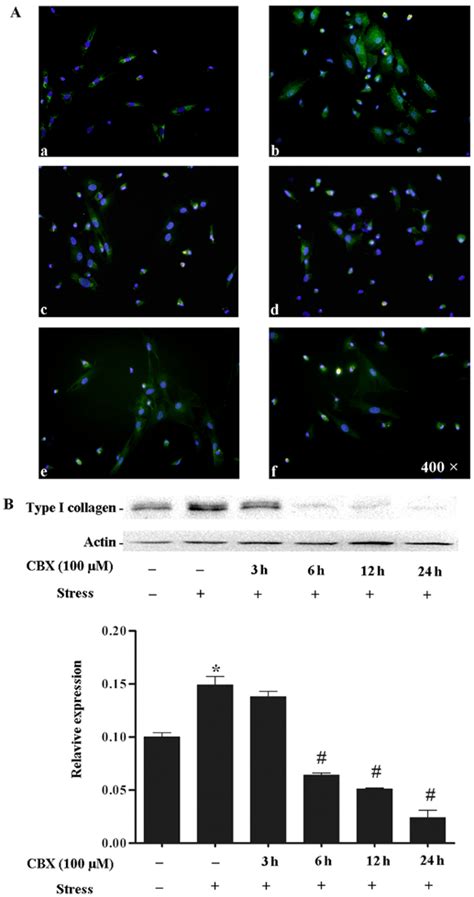 Carbenoxolone Cbx Inhibits Type I Collagen Expression A