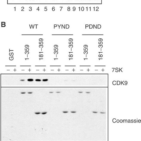 A HEXIM1 Functional Domains Positions Of Amino Acids Are Indicated