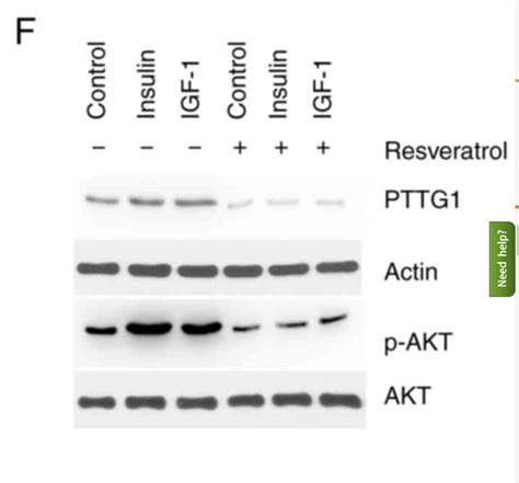 Phospho Pan Akt123 Thr308 Antibody Affinity Biosciences Ltd亲科生物官网