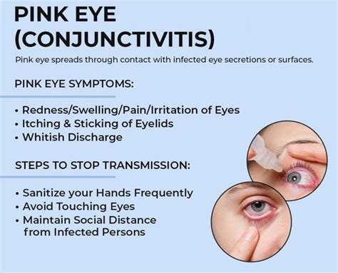 6 Causes Of Pink Eye (Conjunctivitis) - soumyahospitals.com