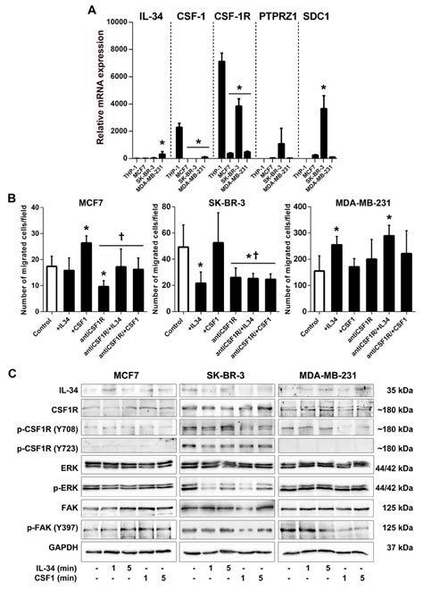 Il 34 Differentially Regulates Migration And Signaling Of Human Breast