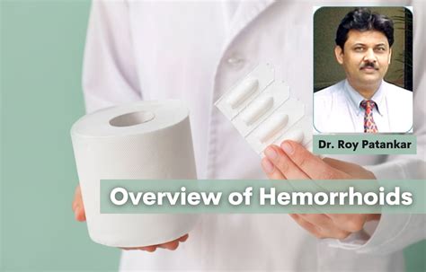 Hemorrhoids Revisited Understanding The Diagnosis Risk Factors And