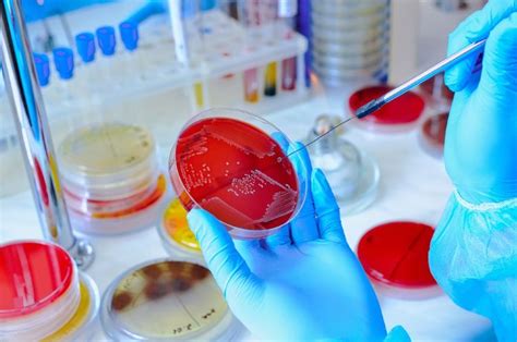 Importance Of Microbiological Testing In Medical Device Manufacture