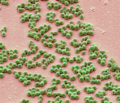 Group A Streptococcus Bacteria 6 By Steve Gschmeissnerscience Photo