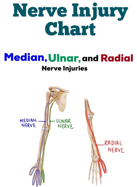 Nerve Injury Dysfunction Chart Median Ulnar Radial Nerves Artofit