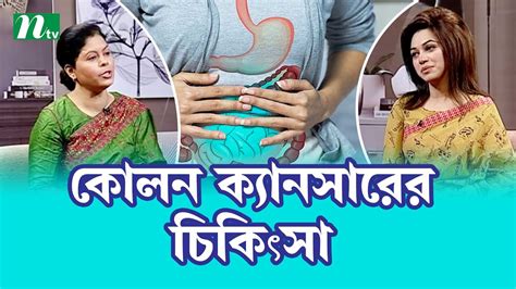 কোলন ক্যানসার কাদের ক্ষেত্রে কী কী চিকিৎসা পদ্ধতি। Health Show