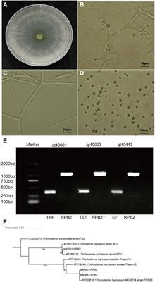 Frontiers Genome Wide Transcriptome Profiling Reveals Molecular