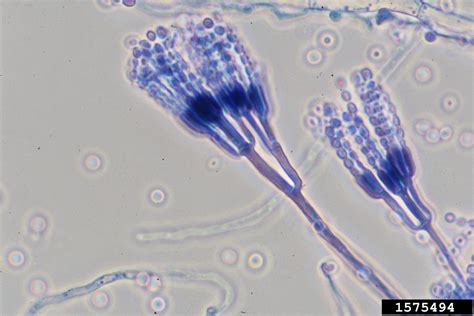 Penicillium Under Microscope