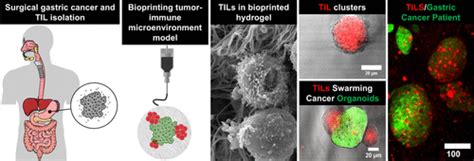 Bioprinted Multicomponent Hydrogel Co Culture Tumor Immune Model For