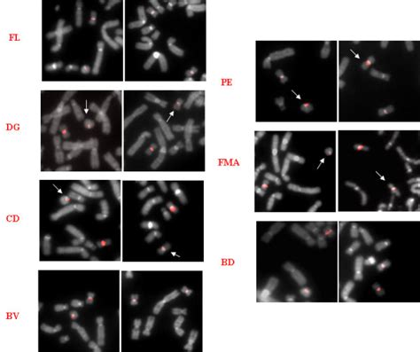 FISH analysis with chromosome 20 specific α satellite DNA probes FISH