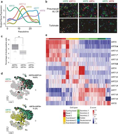 Single Cell Rna Sequencing Reveals Novel Cell Differentiation Dynamics During Human Airway