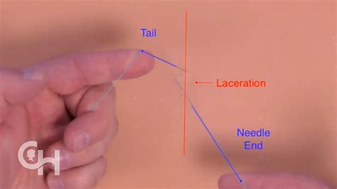 Suture Basics One Hand Knot Tie Left Hand Youtube