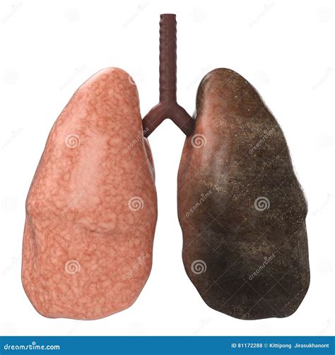 Good and bad lungs stock illustration. Illustration of disease - 81172288