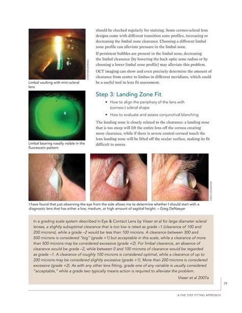 A Guide To Scleral Lens Fitting