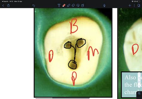 Access Cavity Flashcards Quizlet