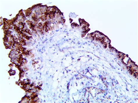 Arginase-1 Antibody (EP261) - Bio SB