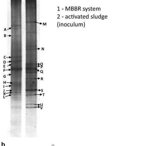 A Dgge Profile Of 16s Rdna Gene Fragments Amplified With Universal