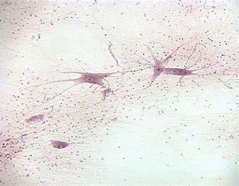 Nervous tissue 100X: General Biology Lab II: Loyola University Chicago