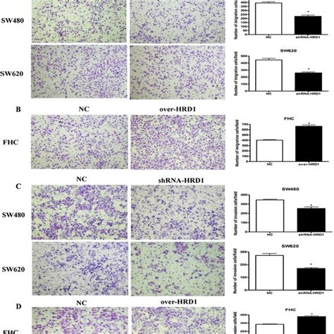 HRD1 Knockdown Inhibiting CC Cell Migration And Invasion A And B