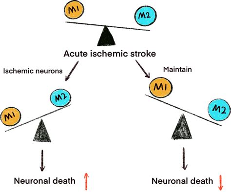 The Roles Of Microglia In Ischemic Stroke The Balance Between