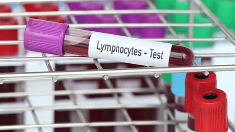 Lymphocytes Test Blood Sample Analyze Laboratory Stock Footage Video ...