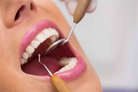 Restoratif Diş Tedavisi Konya Diş Hastanesi Dentium