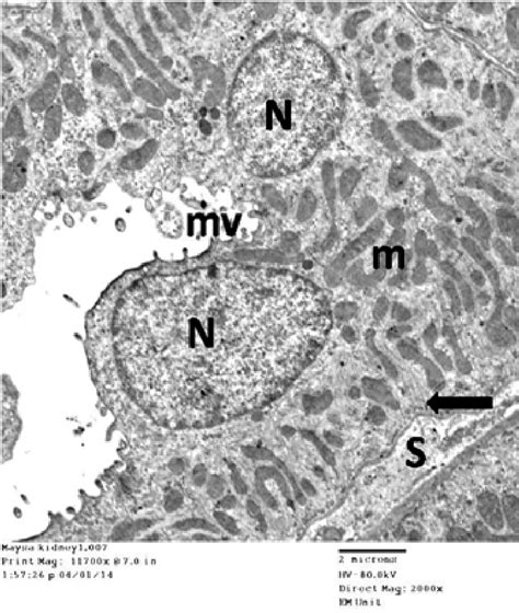 An Electron Micrograph Of An Ultrathin Section In A Distal Convoluted