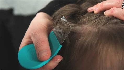 How To Get Rid Of Nits And Head Lice Bathmost9