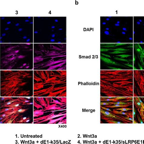 Inhibited nuclear translocation of β catenin and Smad 2 3 by