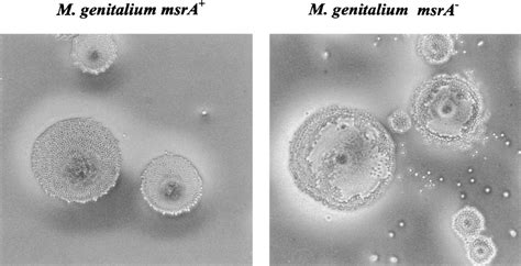 Mycoplasma Ha Assay Using Sheep Erythrocytes A M Genitalium Download Scientific Diagram