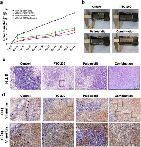 Combination Of Ptc 209 And Palbociclib Inhibited Mda Mb 231 Tumor