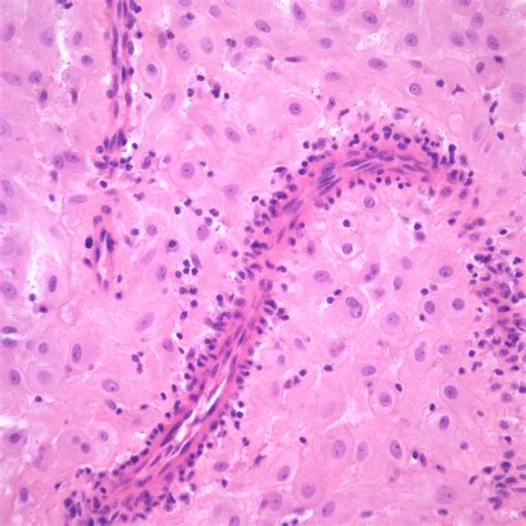 Chapter Placental Perfusion Section A Spiral Arteries Obstetrical