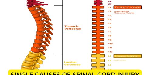 Causes Of Spinal Cord Injury Lose Mobility Or Function