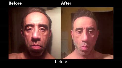 Face Exercises Before And After50year Old Man 10 26 15 Youtube