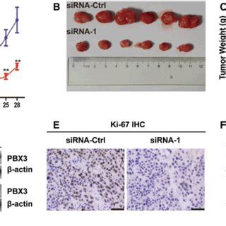 Silencing Of PBX3 Inhibits Glioma Cell Growth In Vivo A LN229 Cells