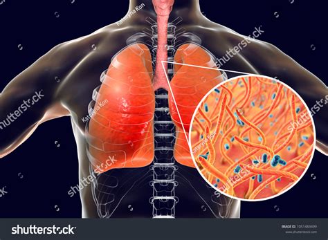 Whooping Cough Bacteria Shape