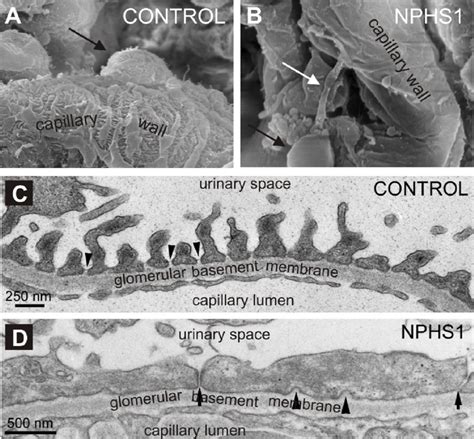 Glomerular Basement Membrane Em