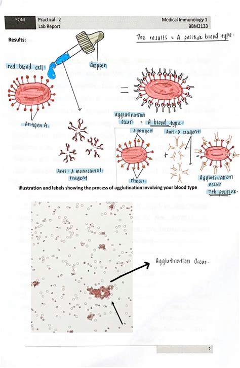 SOLUTION Practical 2 Abo Grouping And Agglutination Immunology Studypool