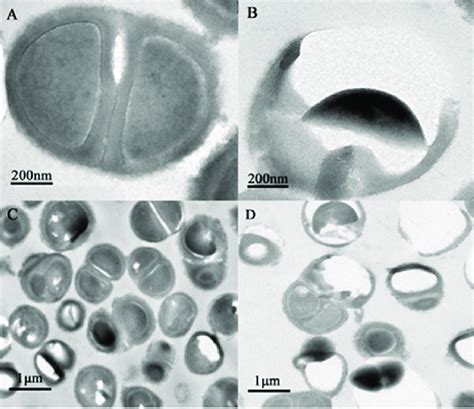 Changes in the bacterial structure photographed under an electron ...