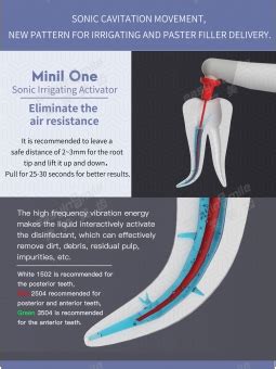 Easyinsmile Endodontic Easydo Endo Activator Oral Mini Sonic Irrigator