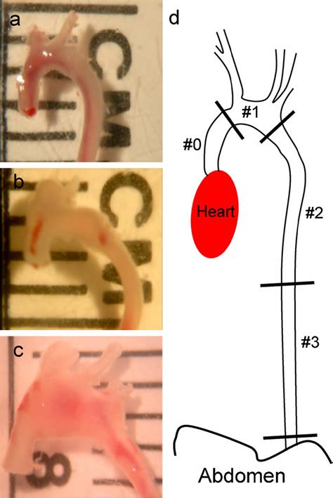 Development And Progression Of Taa In Aortas From The Mgr Mgr Mouse