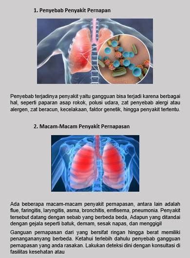 11 Contoh Kliping Penyakit Pernapasan Manusia Jenis Dan Faktor Penyebab