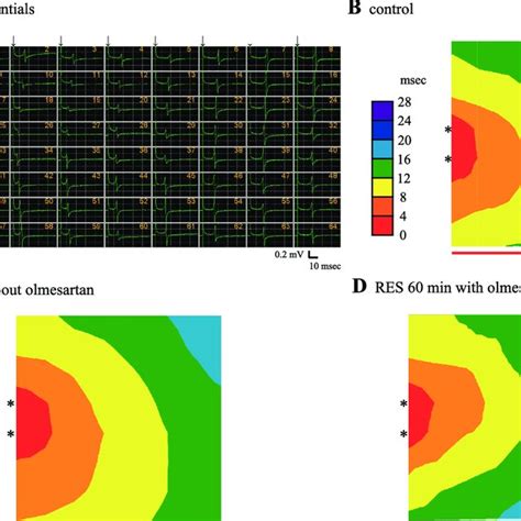 Multielectrode Extracellular Potential Mapping During The Propagation Download Scientific