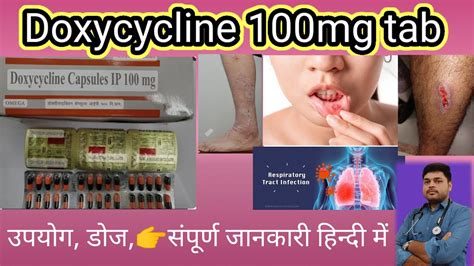 Doxycycline Hyclate 100 Mg Uses In Hindi Doxycycline Side Effects Doxycycline 100 Mg