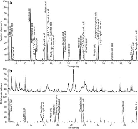 Sections Of Interest Of The A Total Ion Chromatogram Tic Of The