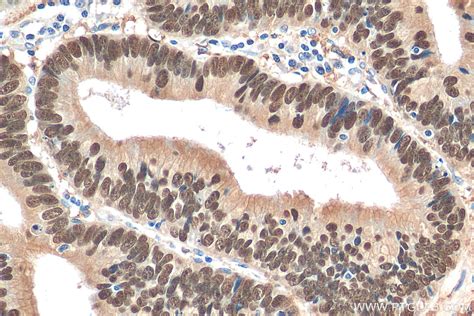 Cdx Antibody Ap Proteintech